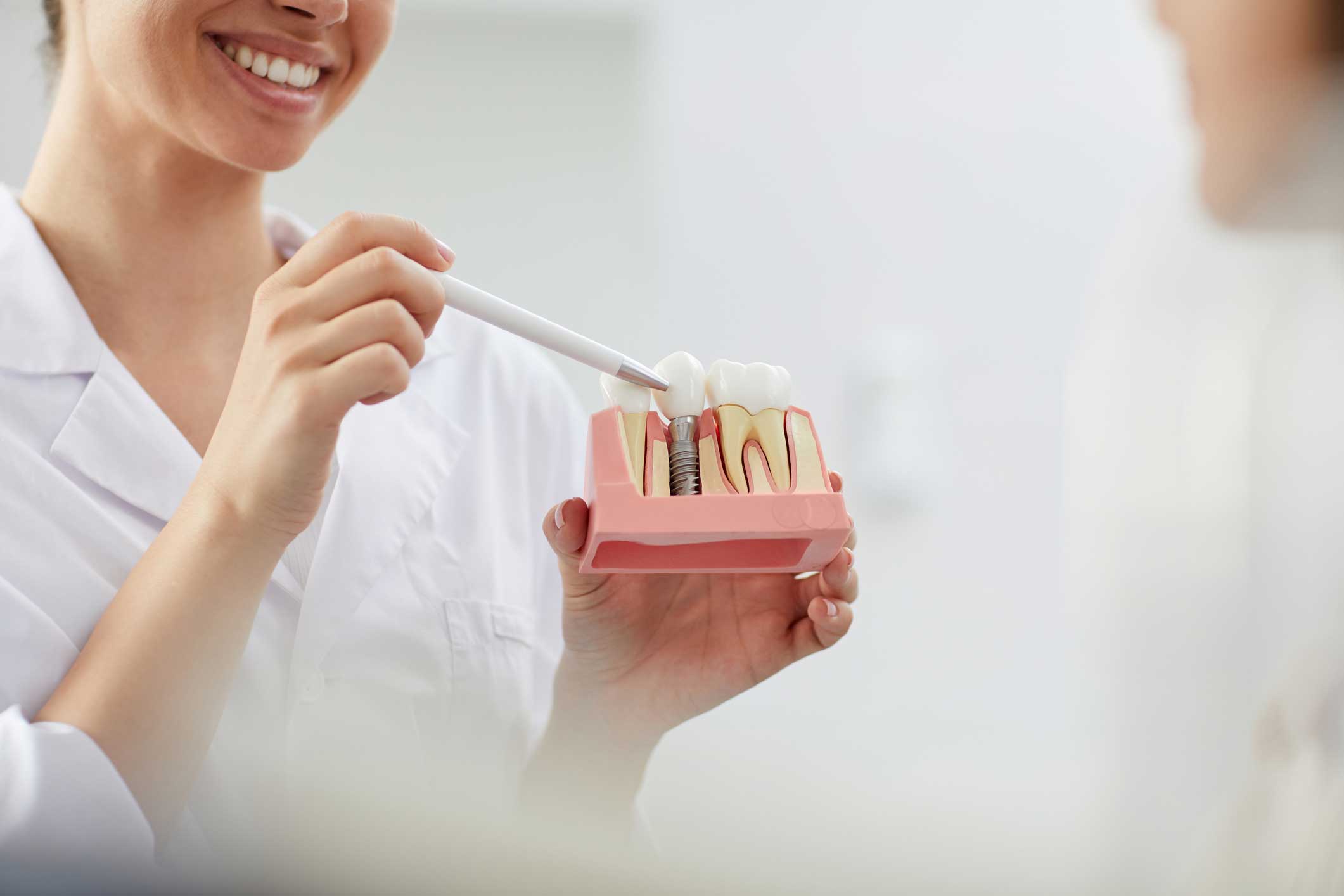 implantes en Majadahonda, Implantología Oral en Majadahonda, cirugía oral en Majadahonda.