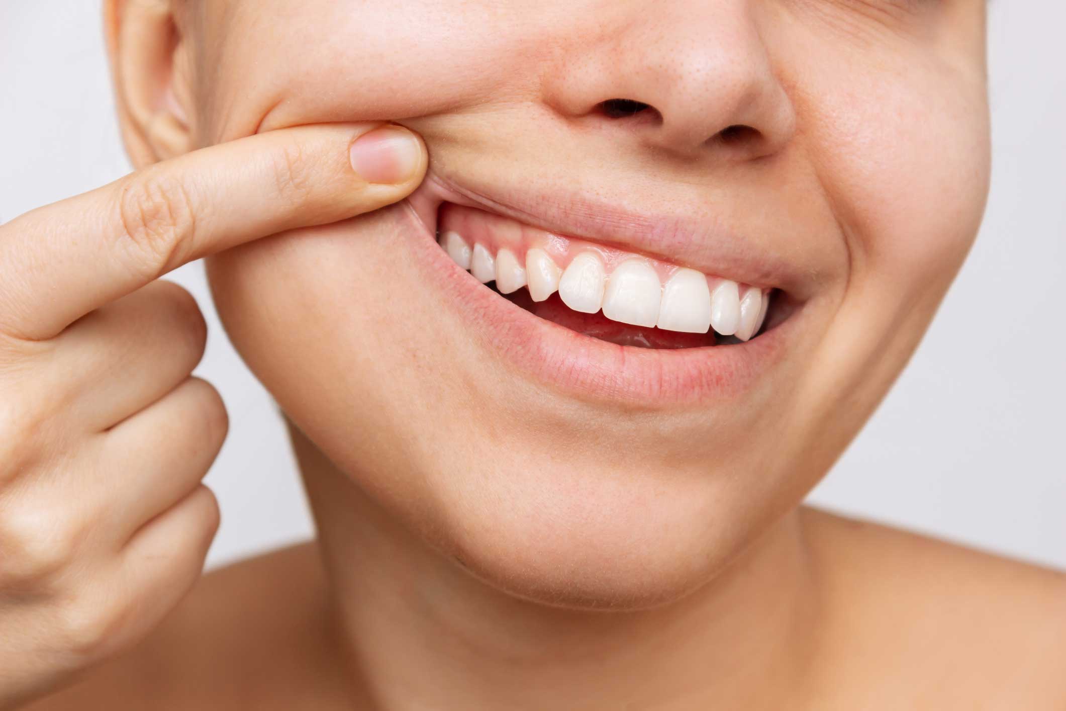 Periodoncia en Majadahonda, tratamiento para las encías en Majadahonda.
