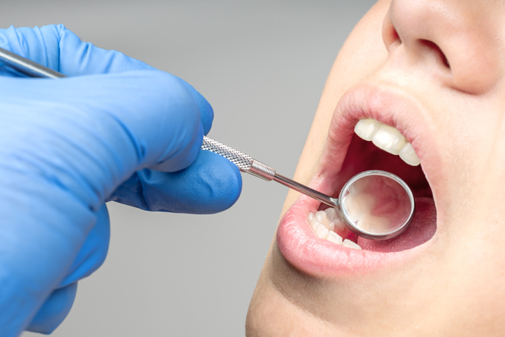 mantenimiento periodontal